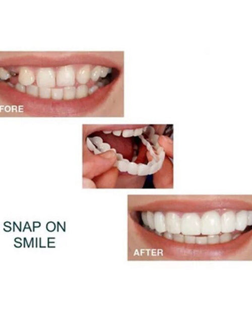 Load image into Gallery viewer, Whitening Braces Simulation Teeth Denture Brace
